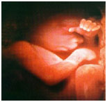 Week 22 Fetal Development