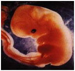 Week 6 Fetal Development